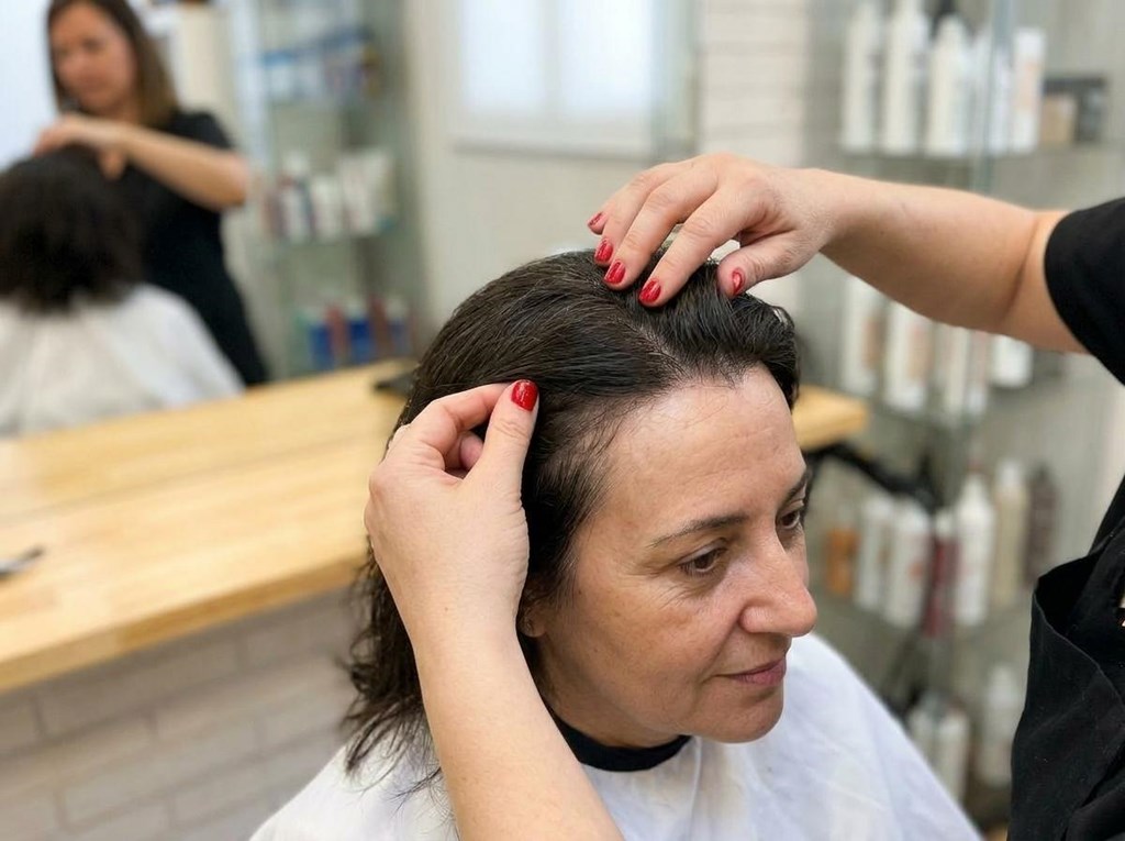 Foto 1 Prótesis capilares en Poio: solución estética para la pérdida de cabello